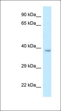 Anti-RDH10 antibody produced in rabbit affinity isolated antibody