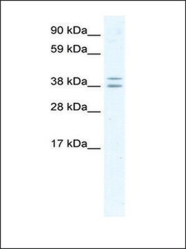 Anti-TSG101 (AB3) antibody produced in rabbit IgG fraction of antiserum