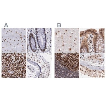 Anti-TERF2 antibody produced in rabbit Ab1, Prestige Antibodies&#174; Powered by Atlas Antibodies, affinity isolated antibody, buffered aqueous glycerol solution