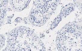 Anti-HSP90 alpha Antibody, clone 4M13 ZooMAb&#174; Rabbit Monoclonal recombinant, expressed in HEK 293 cells