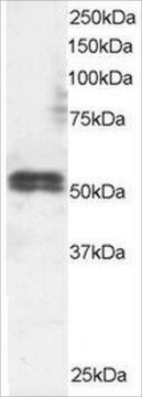 Anti-TFEB, N-Terminal antibody produced in goat affinity isolated antibody, buffered aqueous solution