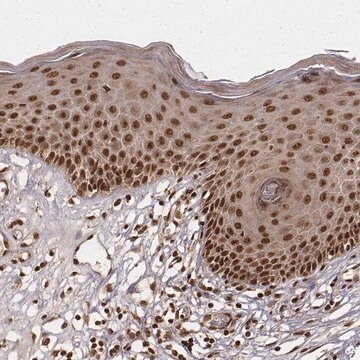 Anti-NFX1 antibody produced in rabbit Prestige Antibodies&#174; Powered by Atlas Antibodies, affinity isolated antibody