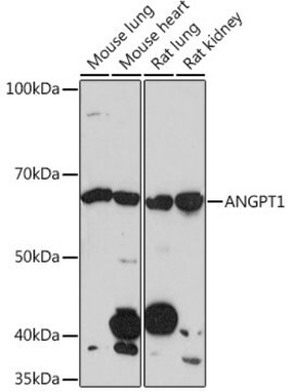 Anti-ANGPT1 Antibody, clone 6C4S7, Rabbit Monoclonal