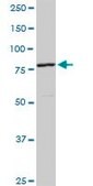 Anti-CUL4A antibody produced in rabbit purified immunoglobulin, buffered aqueous solution
