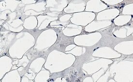 Anti-FABP4 Antibody, clone 1J20 ZooMAb&#174; Rabbit Monoclonal recombinant, expressed in HEK 293 cells