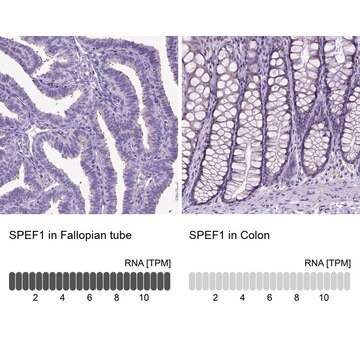 Anti-SPEF1 antibody produced in rabbit Prestige Antibodies&#174; Powered by Atlas Antibodies, affinity isolated antibody, buffered aqueous glycerol solution