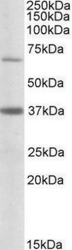 Anti-CPT2 antibody produced in goat affinity isolated antibody, buffered aqueous solution