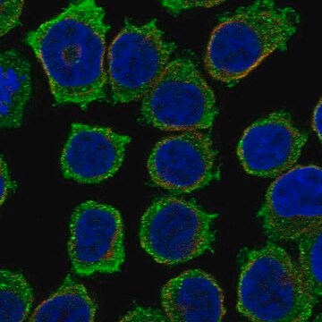 Anti-Itk Antibody Produced In Rabbit Prestige Antibodies&#174; Powered by Atlas Antibodies, affinity isolated antibody, buffered aqueous glycerol solution