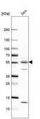 Anti-KRT1 antibody produced in rabbit Prestige Antibodies&#174; Powered by Atlas Antibodies, affinity isolated antibody, buffered aqueous glycerol solution