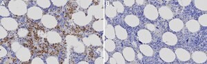 Anti-CD63 Antibody, clone 3G12 ZooMAb&#174; Rabbit Monoclonal recombinant, expressed in HEK 293 cells