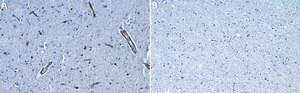 Anti-Laminin &#945;2 80 kDa Antibody, clone 5H2 ZooMAb&#174; Mouse Monoclonal recombinant, expressed in HEK 293 cells