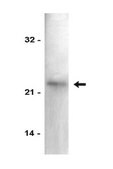 Anti-p21/WAF1/Cip1 Antibody Upstate&#174;, from mouse