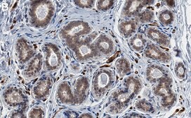 Anti-FABP4 Antibody, clone 1J20 ZooMAb&#174; Rabbit Monoclonal recombinant, expressed in HEK 293 cells
