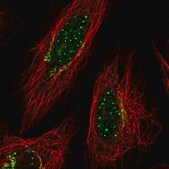 Anti-TYMP antibody produced in rabbit Prestige Antibodies&#174; Powered by Atlas Antibodies, affinity isolated antibody