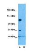 Anti-CACNA2D1 antibody produced in rabbit affinity isolated antibody