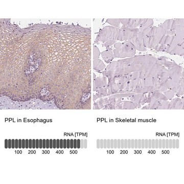 Anti-PPL antibody produced in rabbit Prestige Antibodies&#174; Powered by Atlas Antibodies, affinity isolated antibody, buffered aqueous glycerol solution