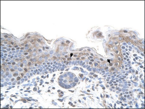 Anti-STRAP (AB1) antibody produced in rabbit affinity isolated antibody