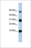 Anti-FABP4 antibody produced in rabbit affinity isolated antibody