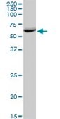 Anti-EPHX2 antibody produced in mouse IgG fraction of antiserum, buffered aqueous solution