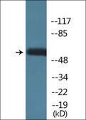 Anti-phospho-Kv1.3/KCNA3 (pTyr135) antibody produced in rabbit affinity isolated antibody