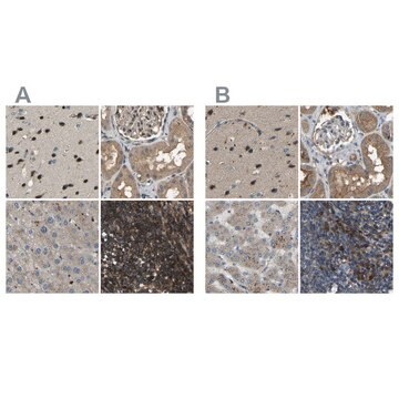 Anti-ATP8B1 antibody produced in rabbit Prestige Antibodies&#174; Powered by Atlas Antibodies, affinity isolated antibody, buffered aqueous glycerol solution, Ab1