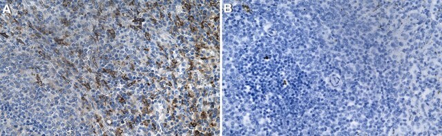 Anti-CD5L Antibody, clone 2D23 ZooMAb&#174; Rabbit Monoclonal recombinant, expressed in HEK 293 cells