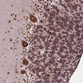 Anti-MTDH antibody produced in rabbit Prestige Antibodies&#174; Powered by Atlas Antibodies, affinity isolated antibody, buffered aqueous glycerol solution