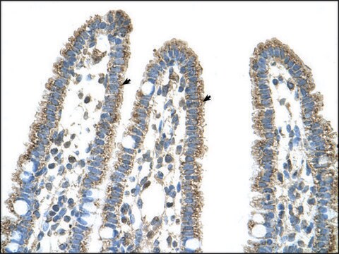 Anti-CPS1 (AB2) antibody produced in rabbit IgG fraction of antiserum