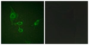Anti-HCK antibody produced in rabbit affinity isolated antibody