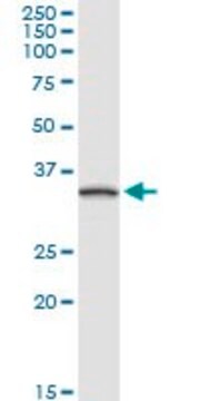 Anti-TNNT1 antibody produced in rabbit purified immunoglobulin, buffered aqueous solution