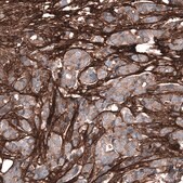 Monoclonal Anti-POSTN antibody produced in mouse Prestige Antibodies&#174; Powered by Atlas Antibodies, clone CL12090, purified immunoglobulin, buffered aqueous glycerol solution