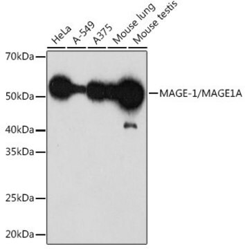 Anti-MAGE-1/MAGE1A antibody produced in rabbit