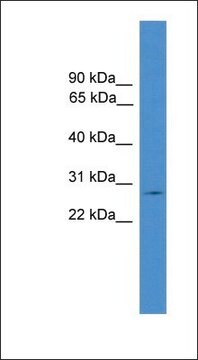 Anti-CLRN1 antibody produced in rabbit affinity isolated antibody