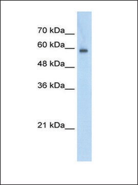 Anti-EIF4G3 antibody produced in rabbit affinity isolated antibody