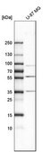 Anti-MMP3 antibody produced in rabbit Prestige Antibodies&#174; Powered by Atlas Antibodies, affinity isolated antibody, buffered aqueous glycerol solution