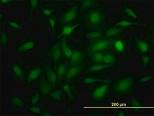 Monoclonal Anti-TYMS antibody produced in mouse clone 3A1, purified immunoglobulin, buffered aqueous solution