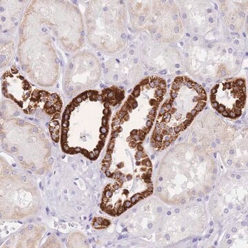 Anti-NKD2 antibody produced in rabbit Prestige Antibodies&#174; Powered by Atlas Antibodies, affinity isolated antibody, buffered aqueous glycerol solution