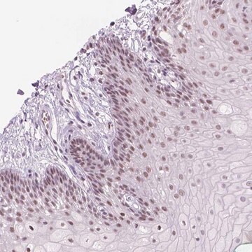 Anti-POLR3D antibody produced in rabbit Prestige Antibodies&#174; Powered by Atlas Antibodies, affinity isolated antibody, buffered aqueous glycerol solution