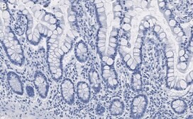 Anti-Brd4 Antibody, clone 1J17 ZooMAb&#174; Rabbit Monoclonal recombinant, expressed in HEK 293 cells