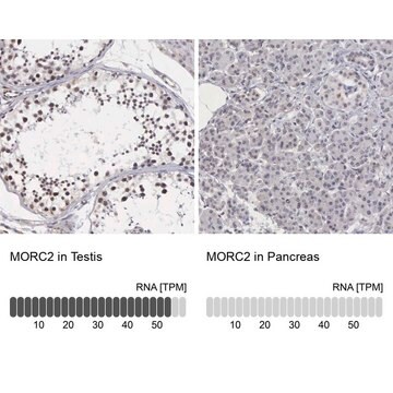 Anti-MORC2 antibody produced in rabbit Prestige Antibodies&#174; Powered by Atlas Antibodies, affinity isolated antibody, buffered aqueous glycerol solution