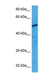 Anti-CHRNA3 antibody produced in rabbit affinity isolated antibody