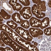 Anti-DDC antibody produced in rabbit Prestige Antibodies&#174; Powered by Atlas Antibodies, affinity isolated antibody, buffered aqueous glycerol solution