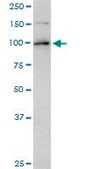 Monoclonal Anti-TOP1 antibody produced in mouse clone 1A1, purified immunoglobulin, buffered aqueous solution