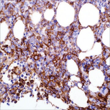 CD13 (SP187) Rabbit Monoclonal Antibody