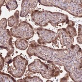 Anti-HDAC5 antibody produced in rabbit Prestige Antibodies&#174; Powered by Atlas Antibodies, affinity isolated antibody, buffered aqueous glycerol solution