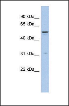 Anti-TRIM14 antibody produced in rabbit affinity isolated antibody