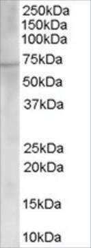 Anti-Choline acetyltransferase antibody produced in goat affinity isolated antibody, buffered aqueous solution