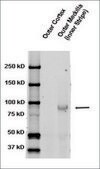 Anti-SCNN1B antibody produced in rabbit 1&#160;mg/mL, affinity isolated antibody