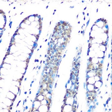 Anti-HP1 gamma/CBX3 antibody produced in rabbit