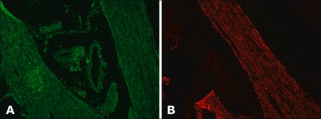 Anti-Desmin antibody, Mouse monoclonal clone DE-U-10, purified from hybridoma cell culture